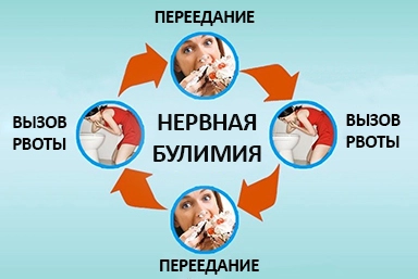 Лечение булимии в Печорах